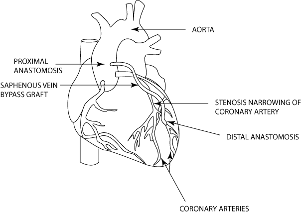 (HEART GRAPHIC)